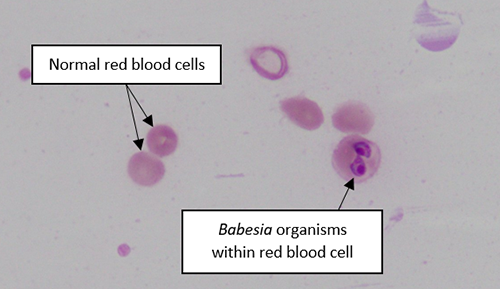 Tick fever parasite within red blood cells