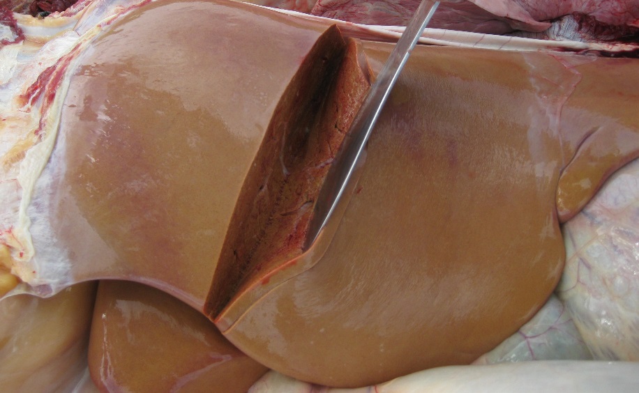 Figure 3: Fatty liver 